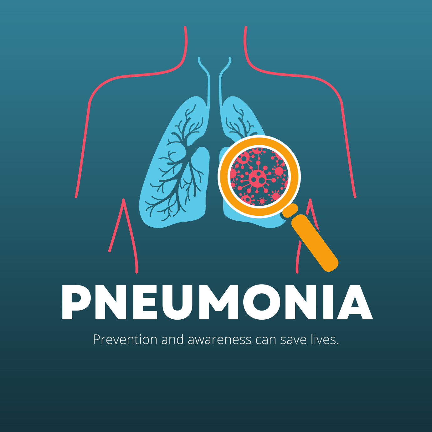 Pneumonia 101: Understanding Causes, Symptoms, and Risk Factors - Daily ...