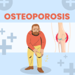 Osteoporosis